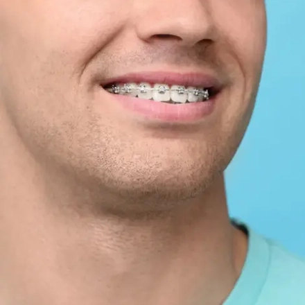 man with braces smiling